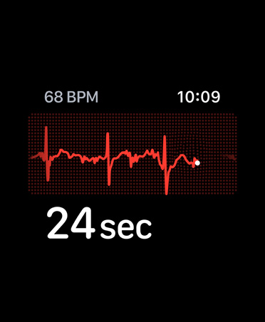 EKG-appen viser slag per minutt oppe i høyre hjørne samt en rytmelinje og nedtelling.